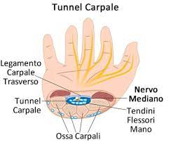 Magnetoterapia tunnel carpale